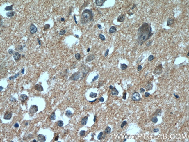 DAOA Antibody in Immunohistochemistry (Paraffin) (IHC (P))