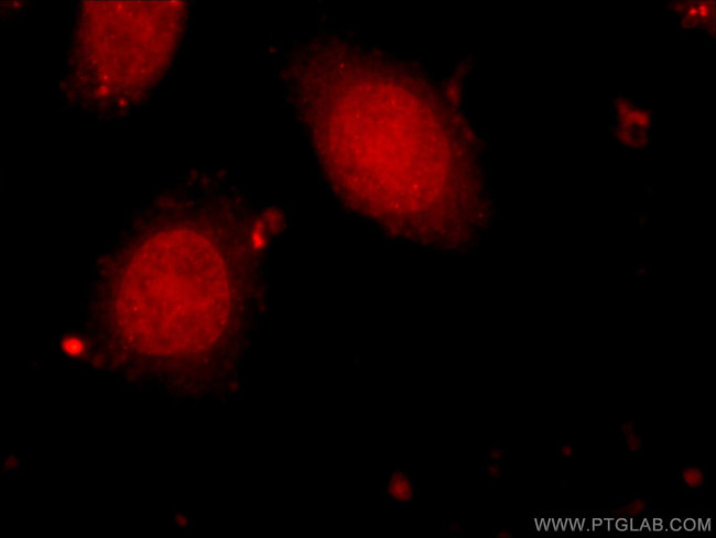 HELB Antibody in Immunocytochemistry (ICC/IF)