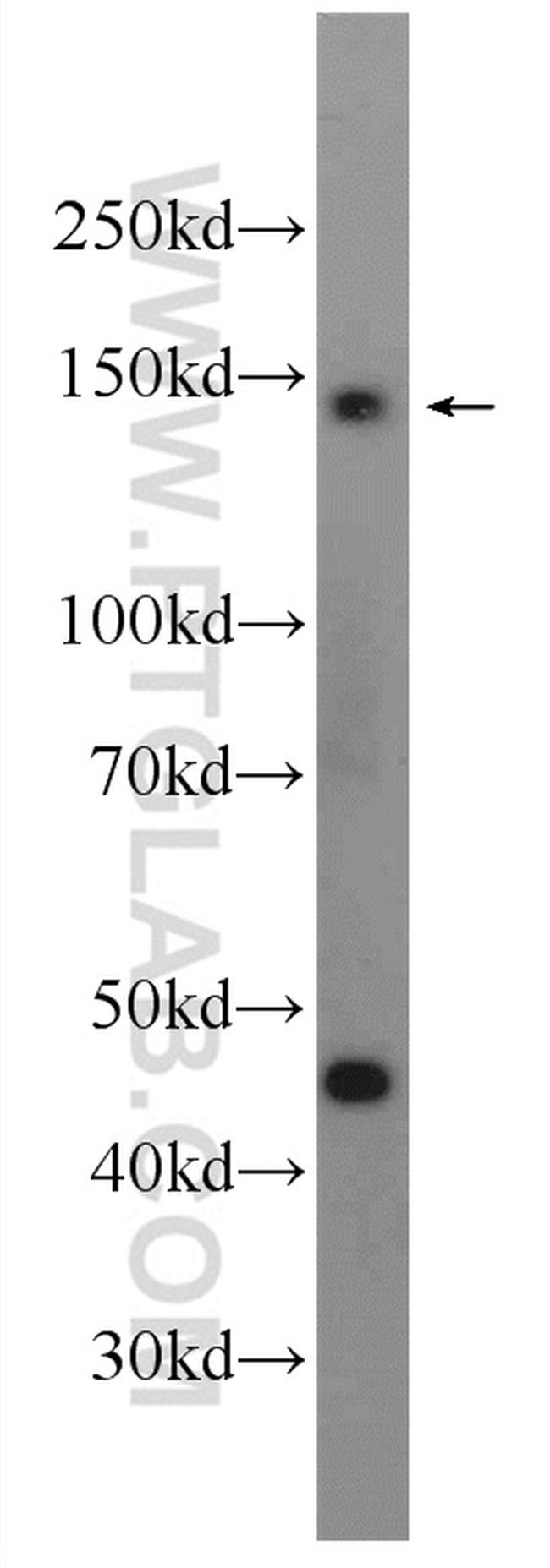 HELB Antibody in Western Blot (WB)