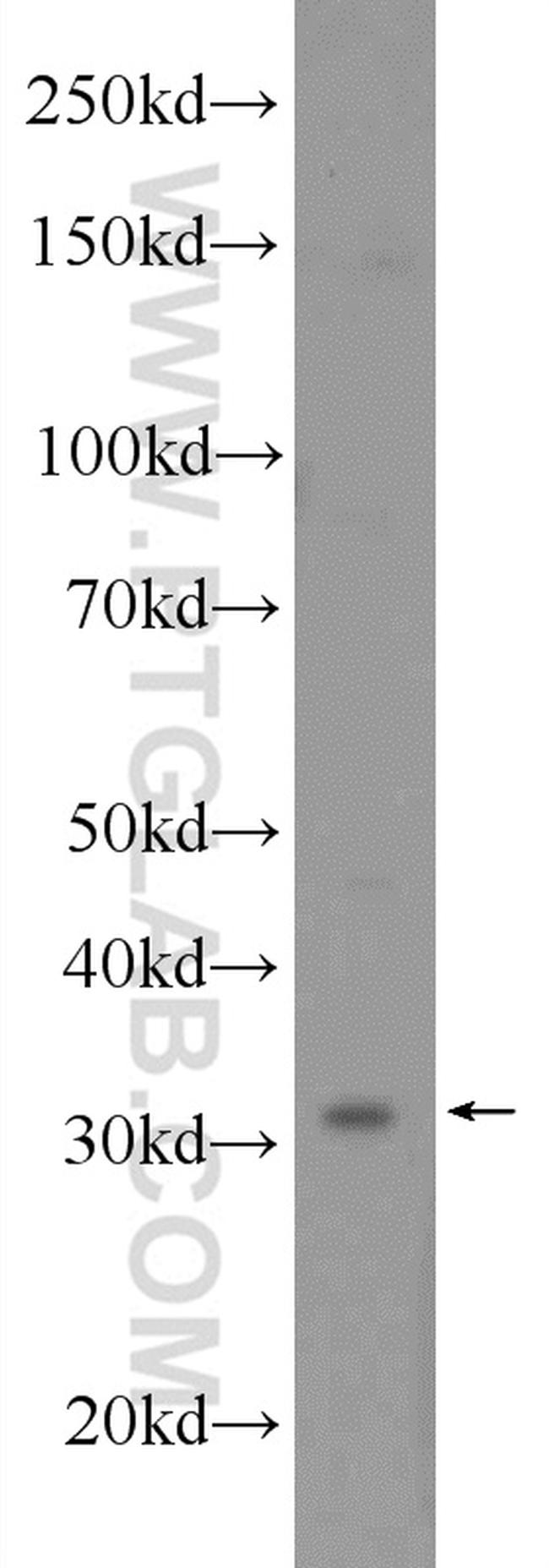 POLR3G Antibody in Western Blot (WB)