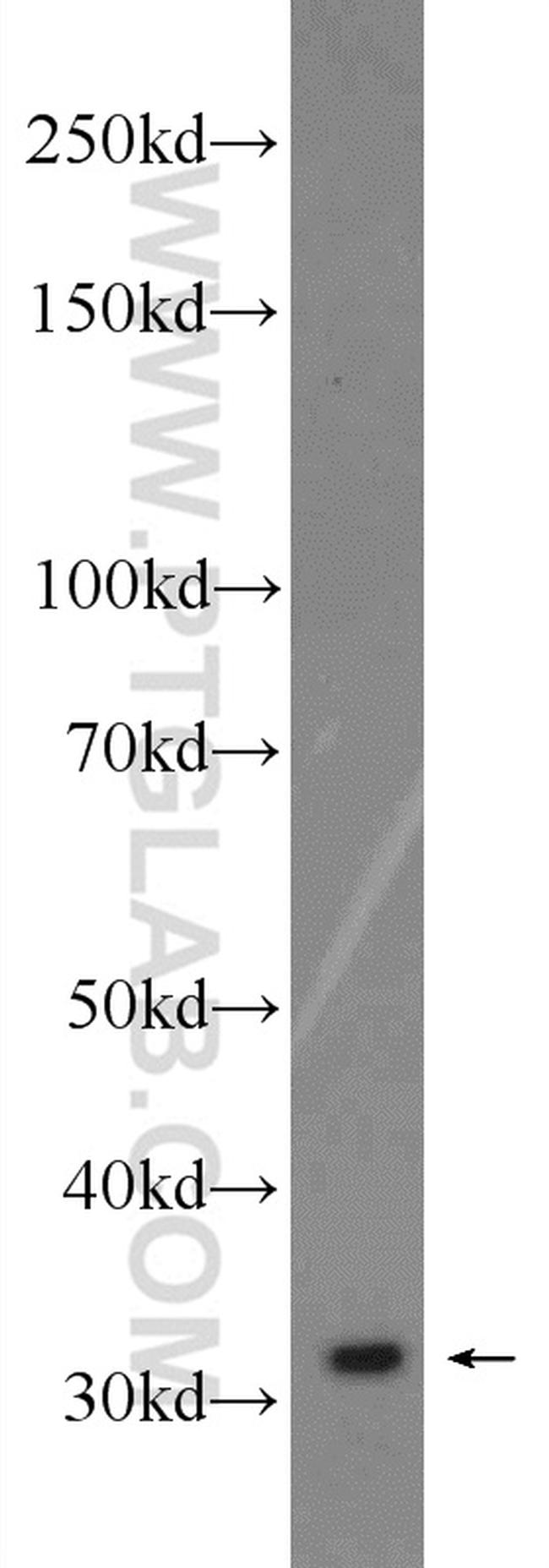 POLR3G Antibody in Western Blot (WB)