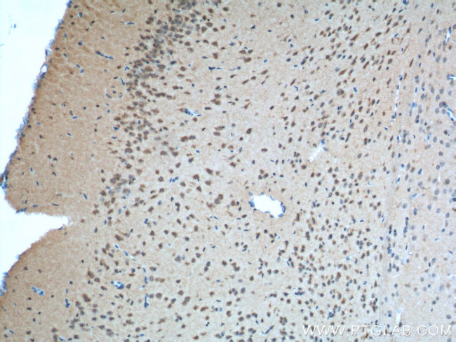 PVRL1 Antibody in Immunohistochemistry (Paraffin) (IHC (P))