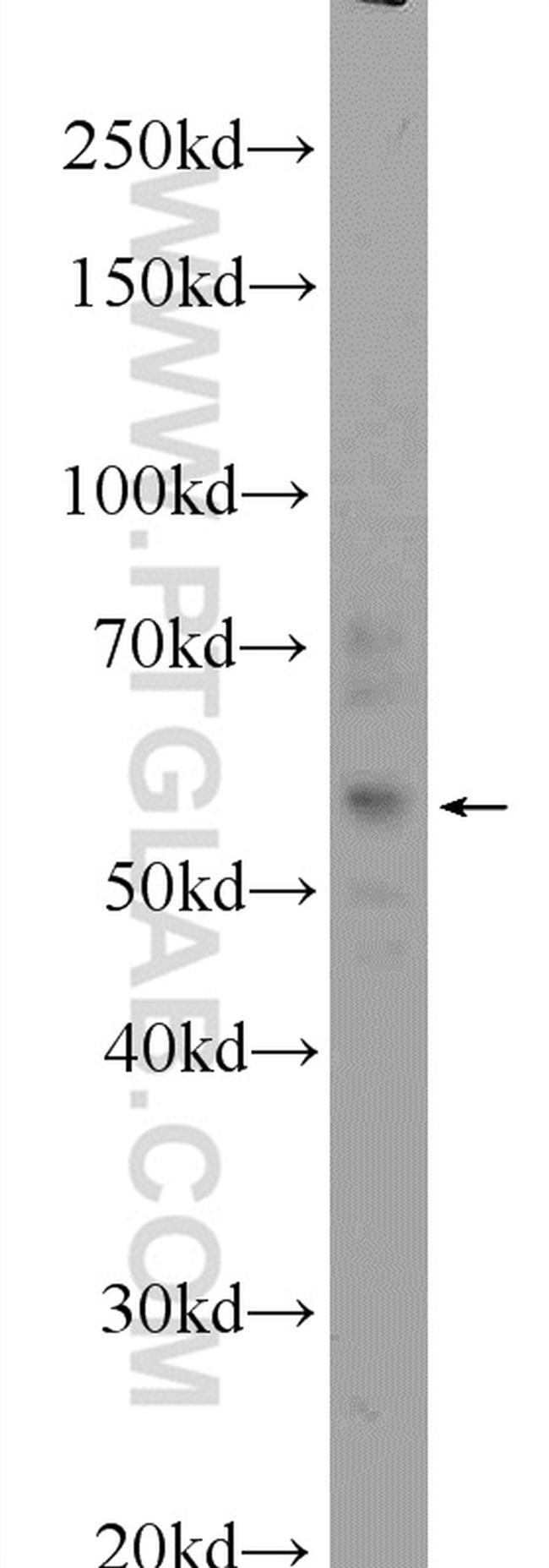 ZFP2 Antibody in Western Blot (WB)