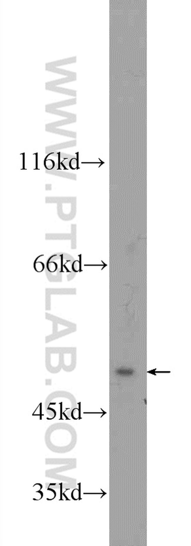 ZFP2 Antibody in Western Blot (WB)