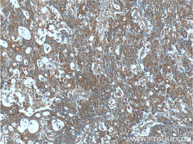 IL36 gamma Antibody in Immunohistochemistry (Paraffin) (IHC (P))