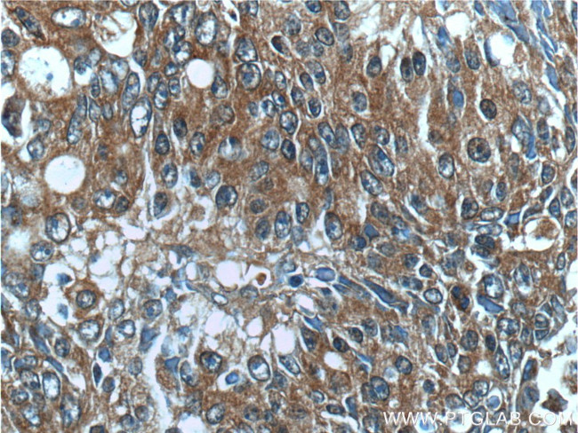 IL36 gamma Antibody in Immunohistochemistry (Paraffin) (IHC (P))