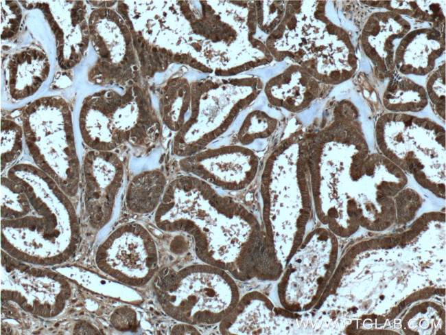 IL36 gamma Antibody in Immunohistochemistry (Paraffin) (IHC (P))