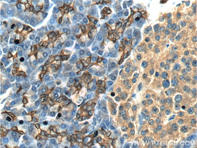 IL36 gamma Antibody in Immunohistochemistry (Paraffin) (IHC (P))