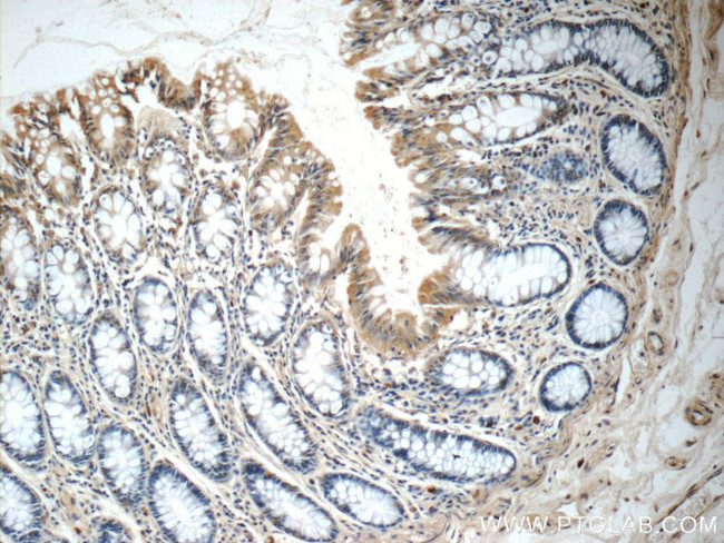 FGFBP3 Antibody in Immunohistochemistry (Paraffin) (IHC (P))