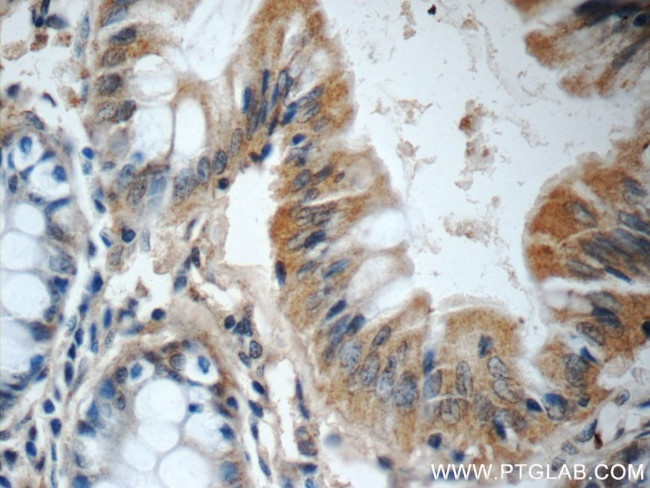 FGFBP3 Antibody in Immunohistochemistry (Paraffin) (IHC (P))