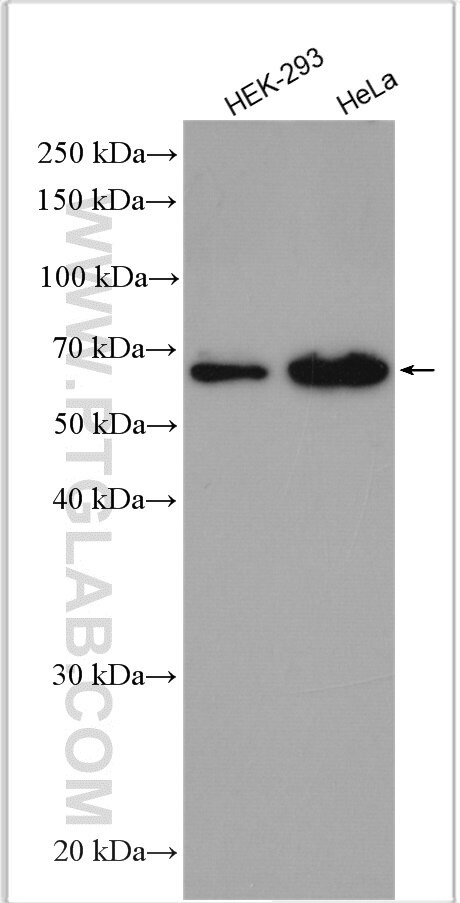 FGFBP3 Antibody in Western Blot (WB)