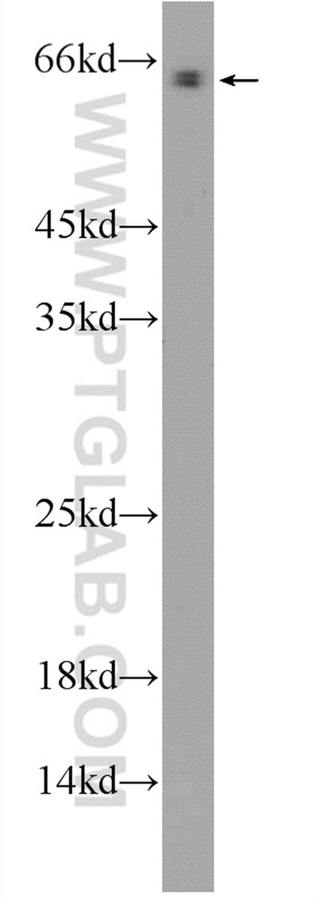 FGFBP3 Antibody in Western Blot (WB)