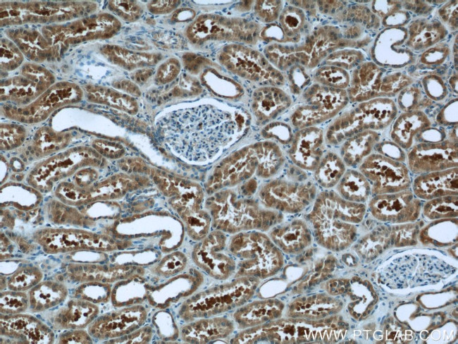 EFTUD1 Antibody in Immunohistochemistry (Paraffin) (IHC (P))