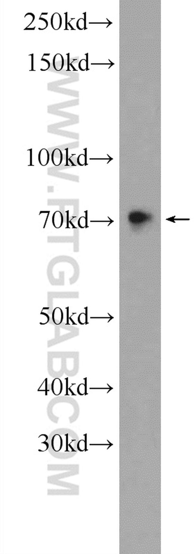 SAMD11 Antibody in Western Blot (WB)