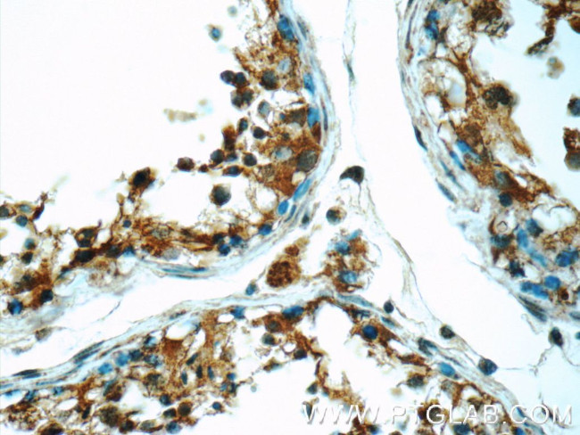 ODF1 Antibody in Immunohistochemistry (Paraffin) (IHC (P))