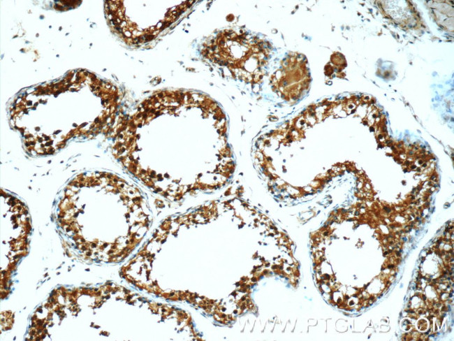 ODF1 Antibody in Immunohistochemistry (Paraffin) (IHC (P))