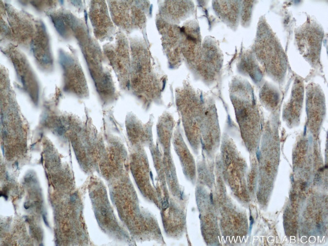 C14orf159 Antibody in Immunohistochemistry (Paraffin) (IHC (P))