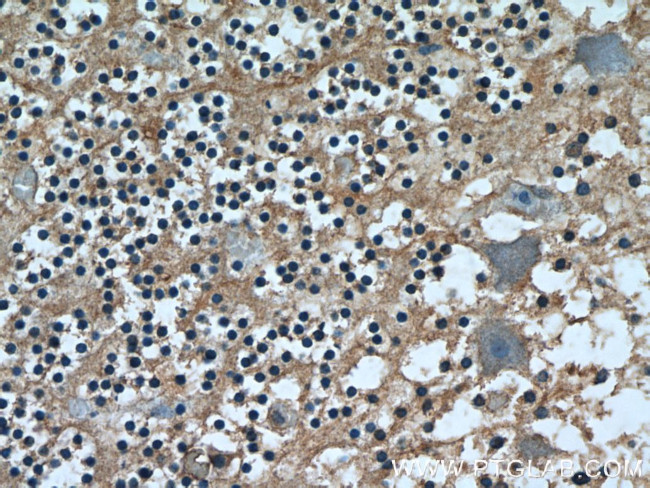 HYDIN Antibody in Immunohistochemistry (Paraffin) (IHC (P))