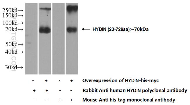 HYDIN Antibody in Western Blot (WB)