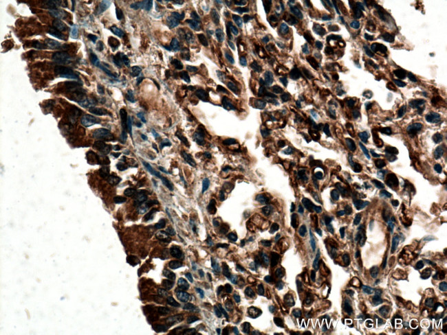 ACE Antibody in Immunohistochemistry (Paraffin) (IHC (P))