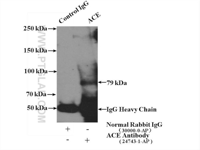 ACE Antibody in Immunoprecipitation (IP)