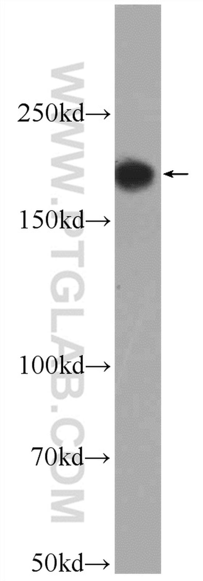 ACE Antibody in Western Blot (WB)