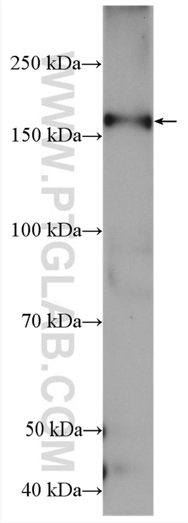 ACE Antibody in Western Blot (WB)