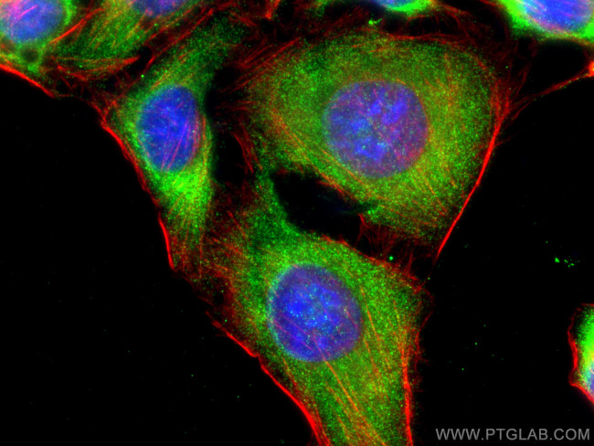 YTHDF2 Antibody in Immunocytochemistry (ICC/IF)