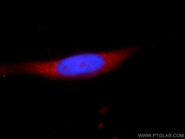 YTHDF2 Antibody in Immunocytochemistry (ICC/IF)