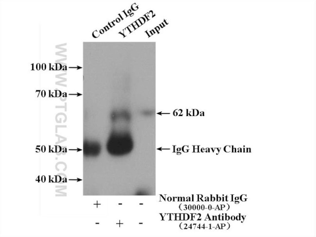 YTHDF2 Antibody in Immunoprecipitation (IP)