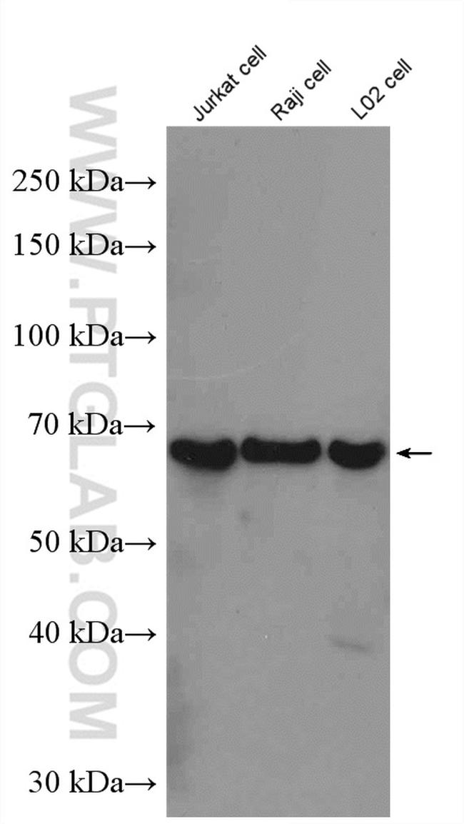 YTHDF2 Antibody in Western Blot (WB)