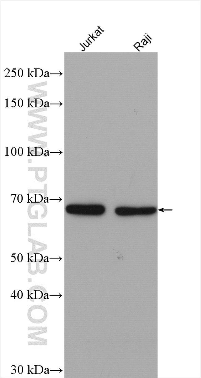 YTHDF2 Antibody in Western Blot (WB)