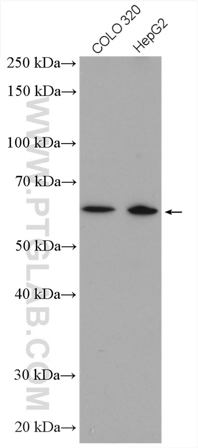 ZNF674 Antibody in Western Blot (WB)