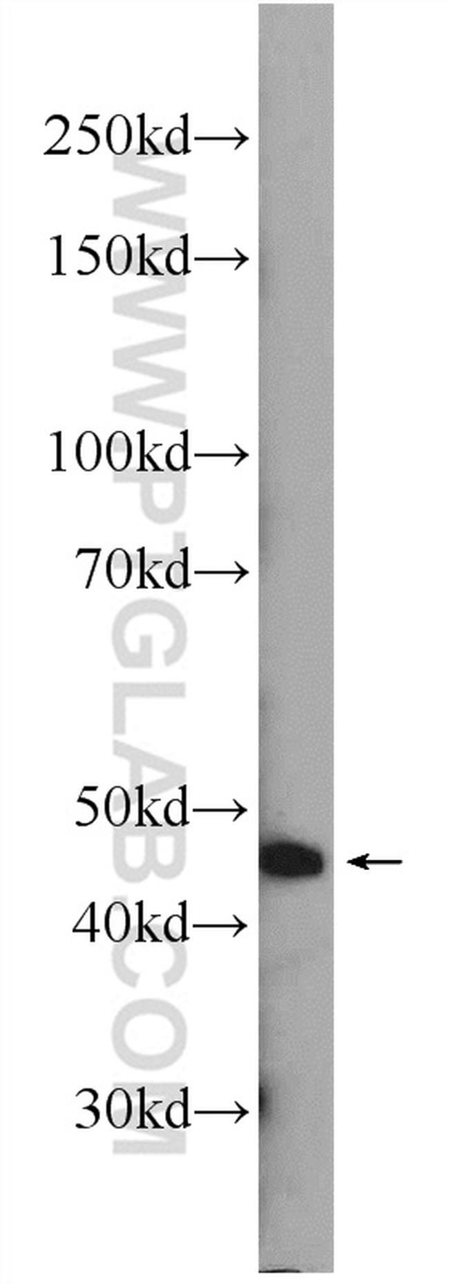 ZDHHC13 Antibody in Western Blot (WB)