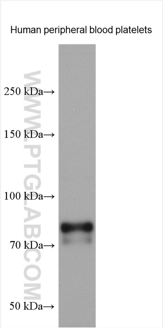 TPOR/MPL Antibody in Western Blot (WB)