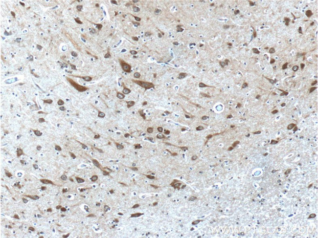 PTGER3 Antibody in Immunohistochemistry (Paraffin) (IHC (P))