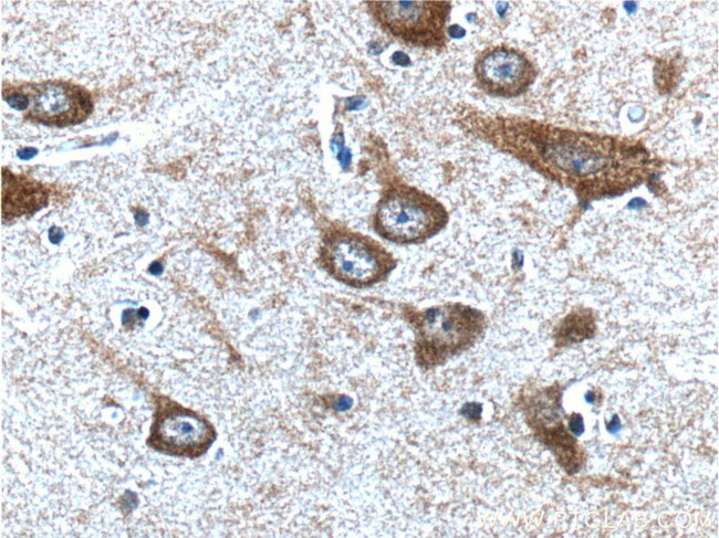 PTGER3 Antibody in Immunohistochemistry (Paraffin) (IHC (P))