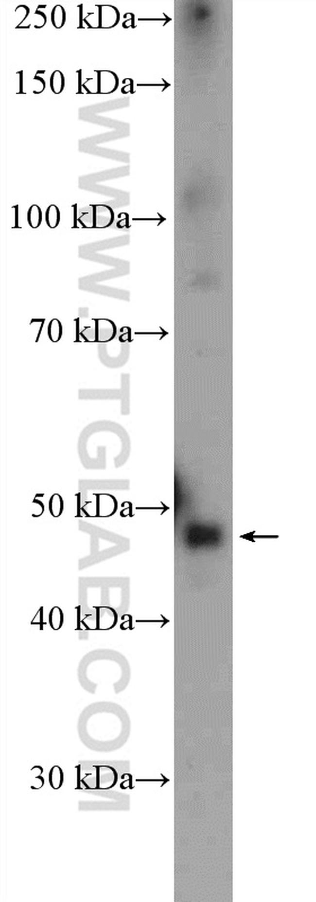 PTGER3 Antibody in Western Blot (WB)