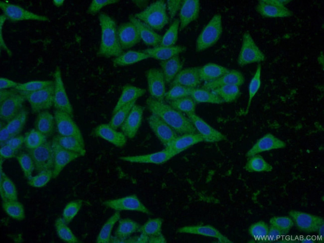 INSIG2 Antibody in Immunocytochemistry (ICC/IF)