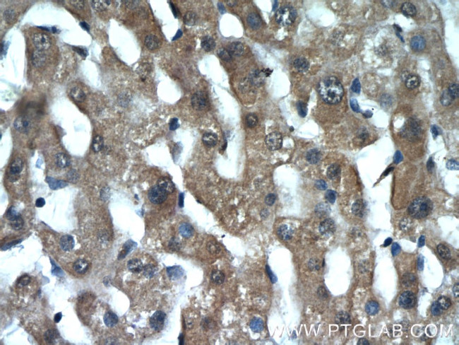 INSIG2 Antibody in Immunohistochemistry (Paraffin) (IHC (P))