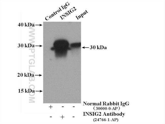 INSIG2 Antibody in Immunoprecipitation (IP)