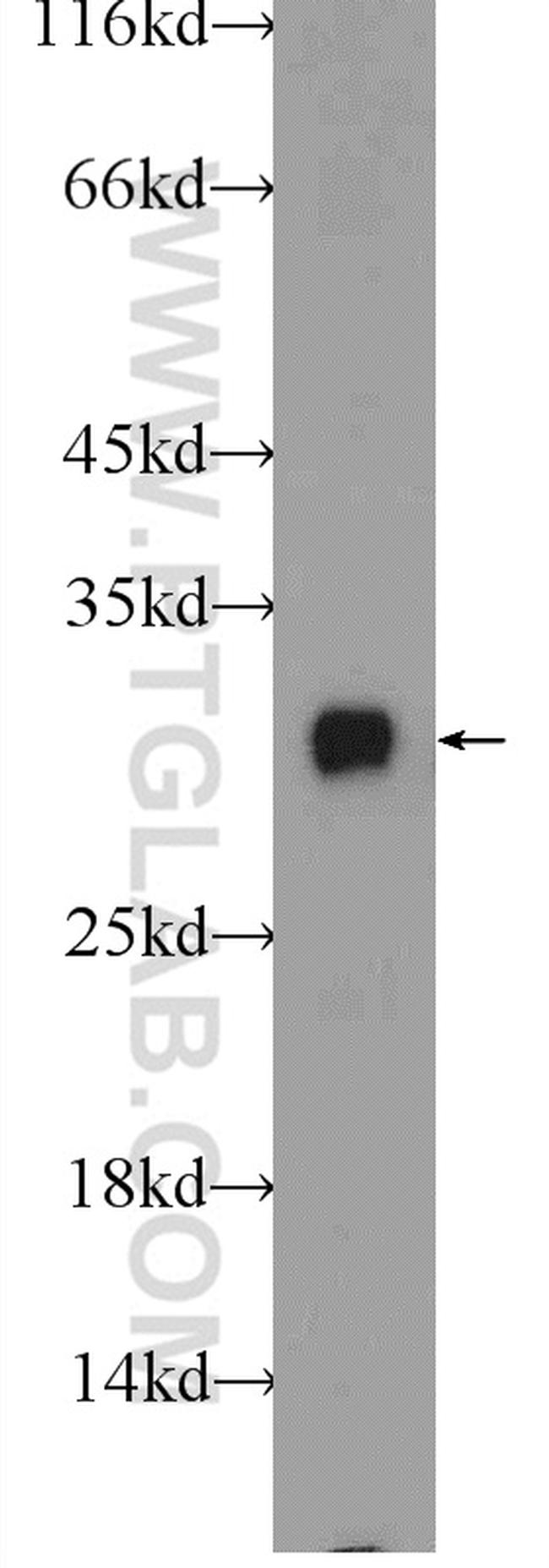 INSIG2 Antibody in Western Blot (WB)