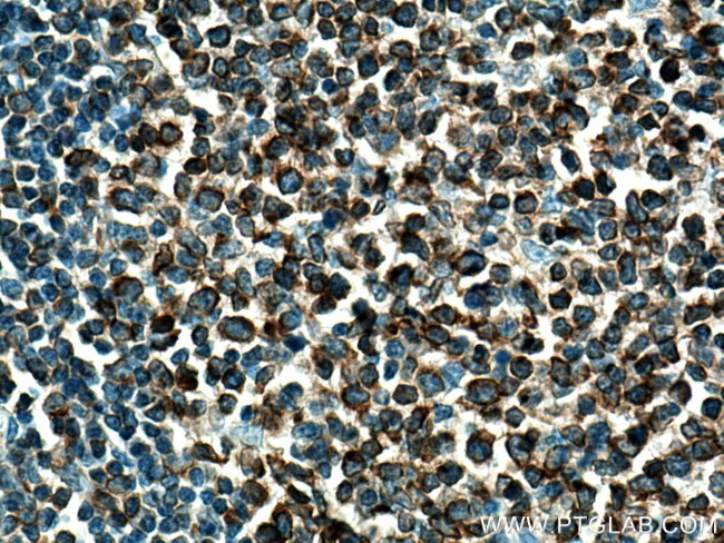 LRMP Antibody in Immunohistochemistry (Paraffin) (IHC (P))