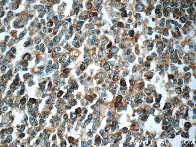 LRMP Antibody in Immunohistochemistry (Paraffin) (IHC (P))