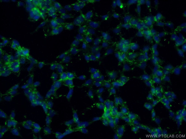 Caspase 2/p18 Antibody in Immunocytochemistry (ICC/IF)