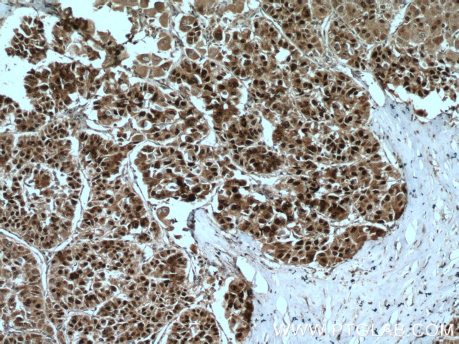 Caspase 2/p18 Antibody in Immunohistochemistry (Paraffin) (IHC (P))