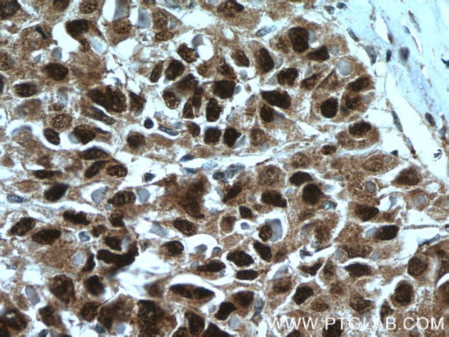 Caspase 2/p18 Antibody in Immunohistochemistry (Paraffin) (IHC (P))