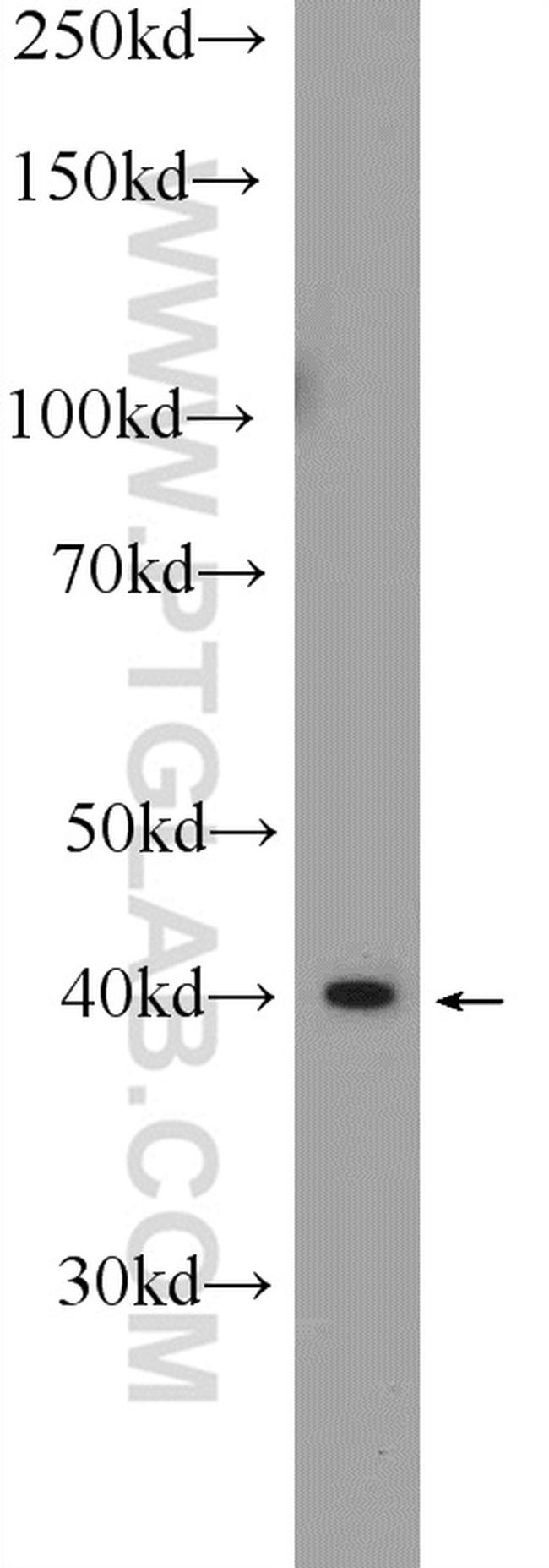 IKZF5 Antibody in Western Blot (WB)