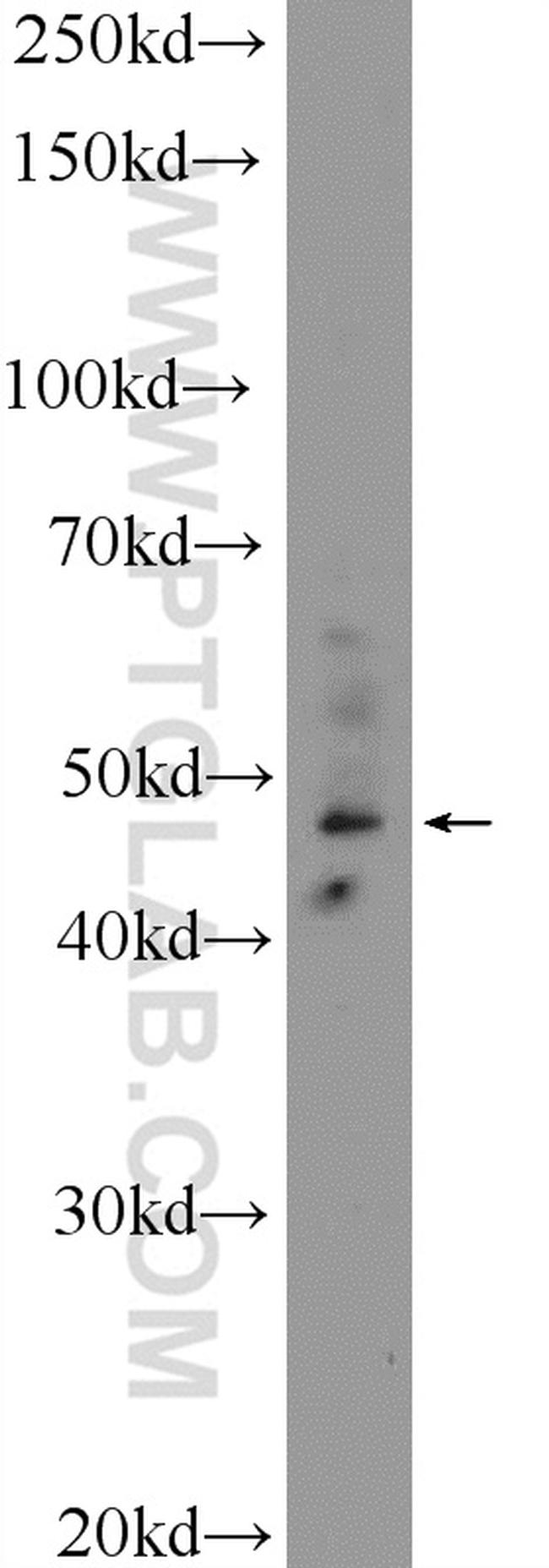 IKZF5 Antibody in Western Blot (WB)