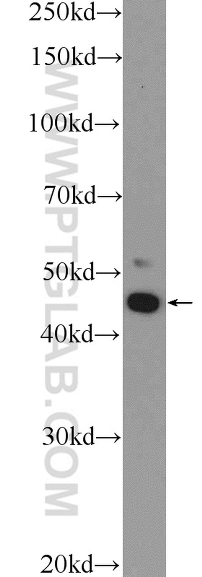 IKZF5 Antibody in Western Blot (WB)